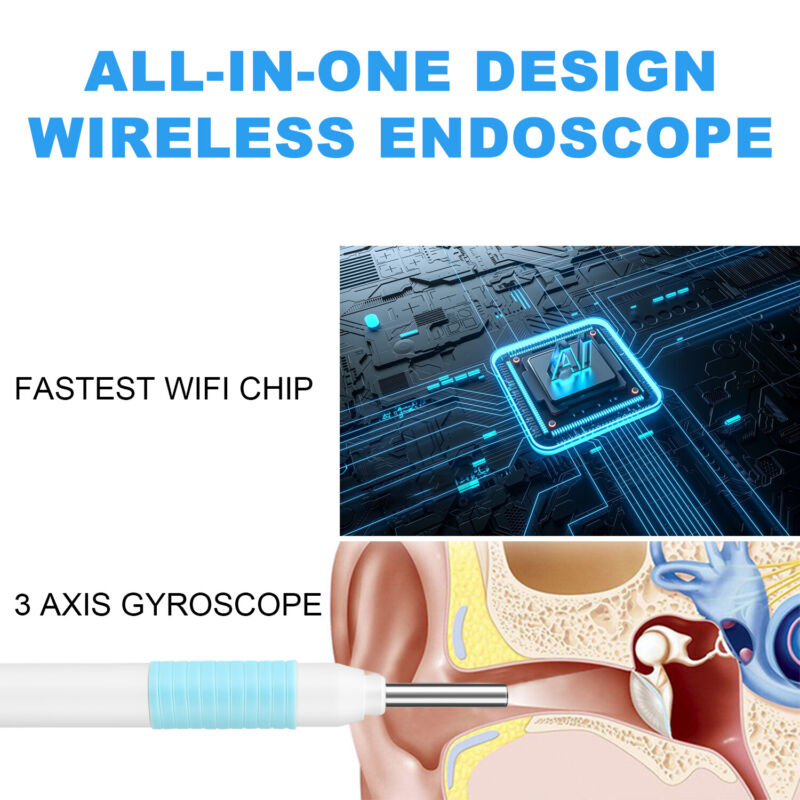 Wireless Endoscope