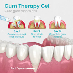 Gum Shield Therapy Gel